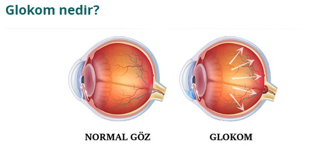 Canan Aslı Utine Yıldırım-7