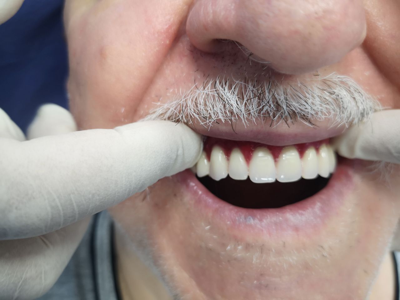 Stefano De Simone-99