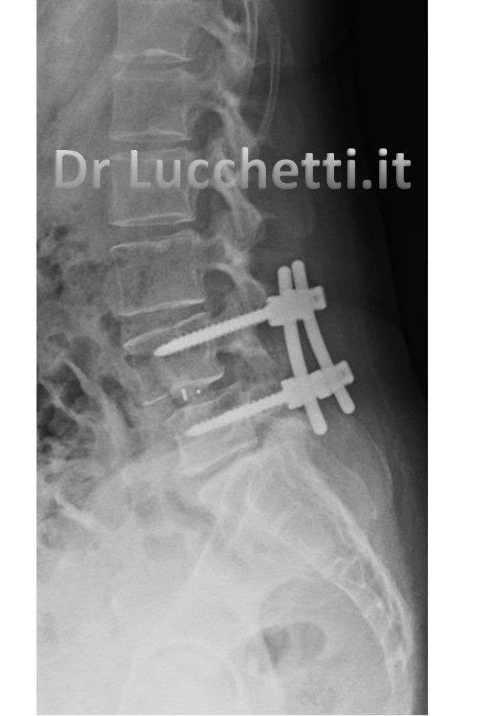 Francesco Lucchetti-3