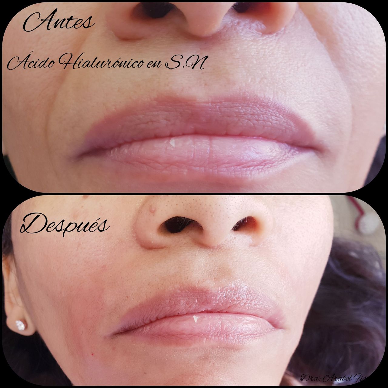 Arabel Fis Rodríguez-16