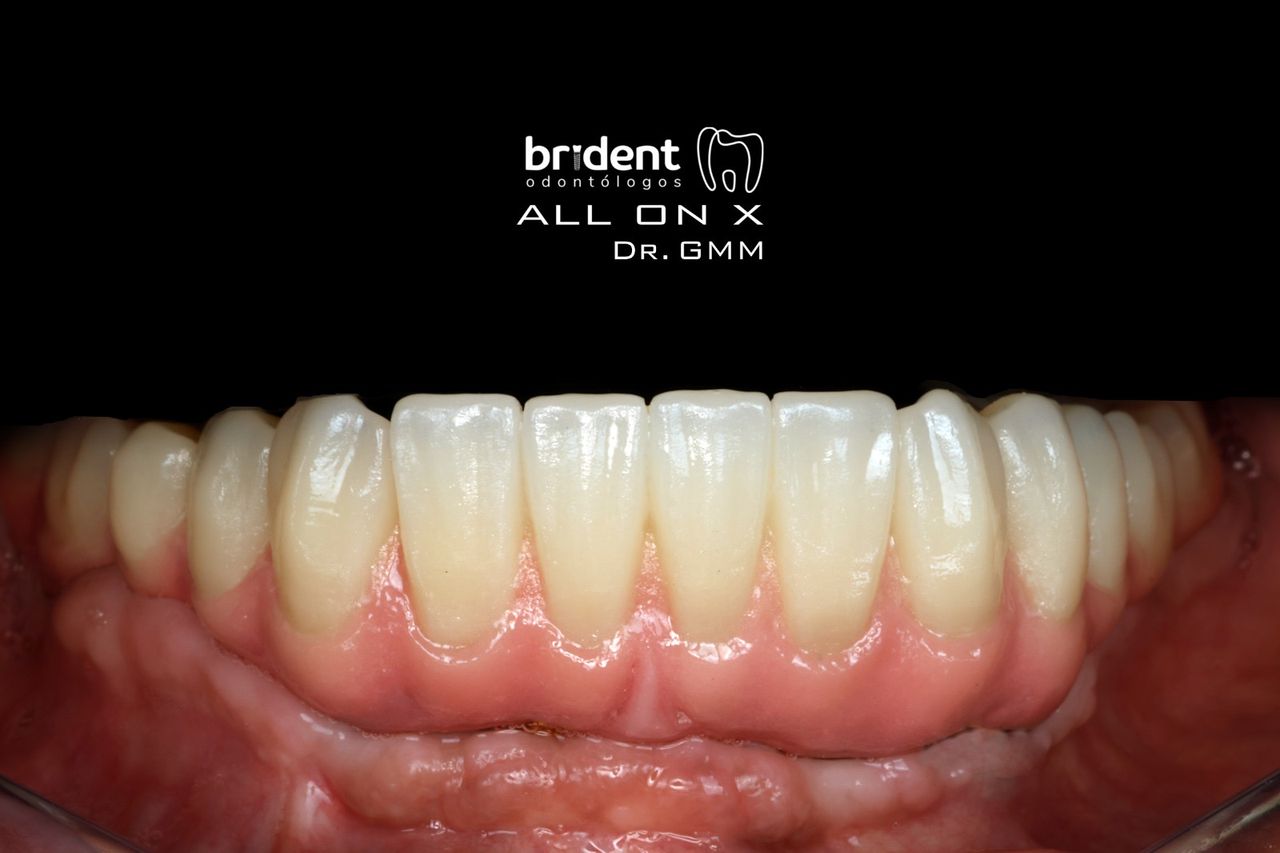 Guillermo Moreno Masiá-59