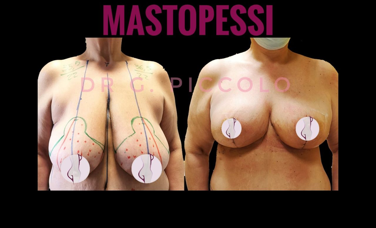 Giuseppina Piccolo-43