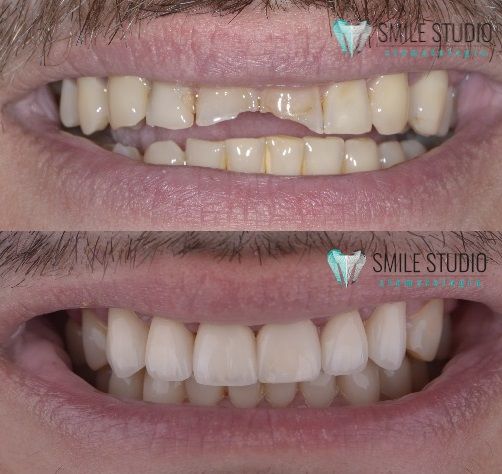 Michał Jankowski-11