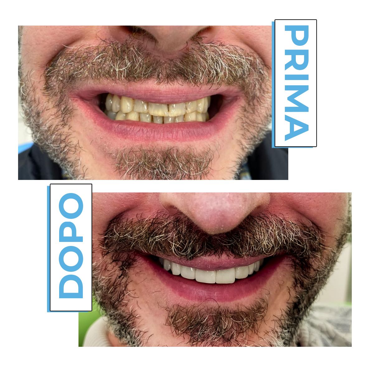 Francesco Anaclerico-22