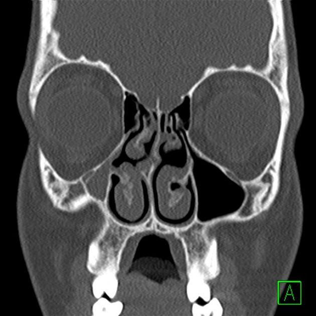 Francesco Zappoli Thyrion-7