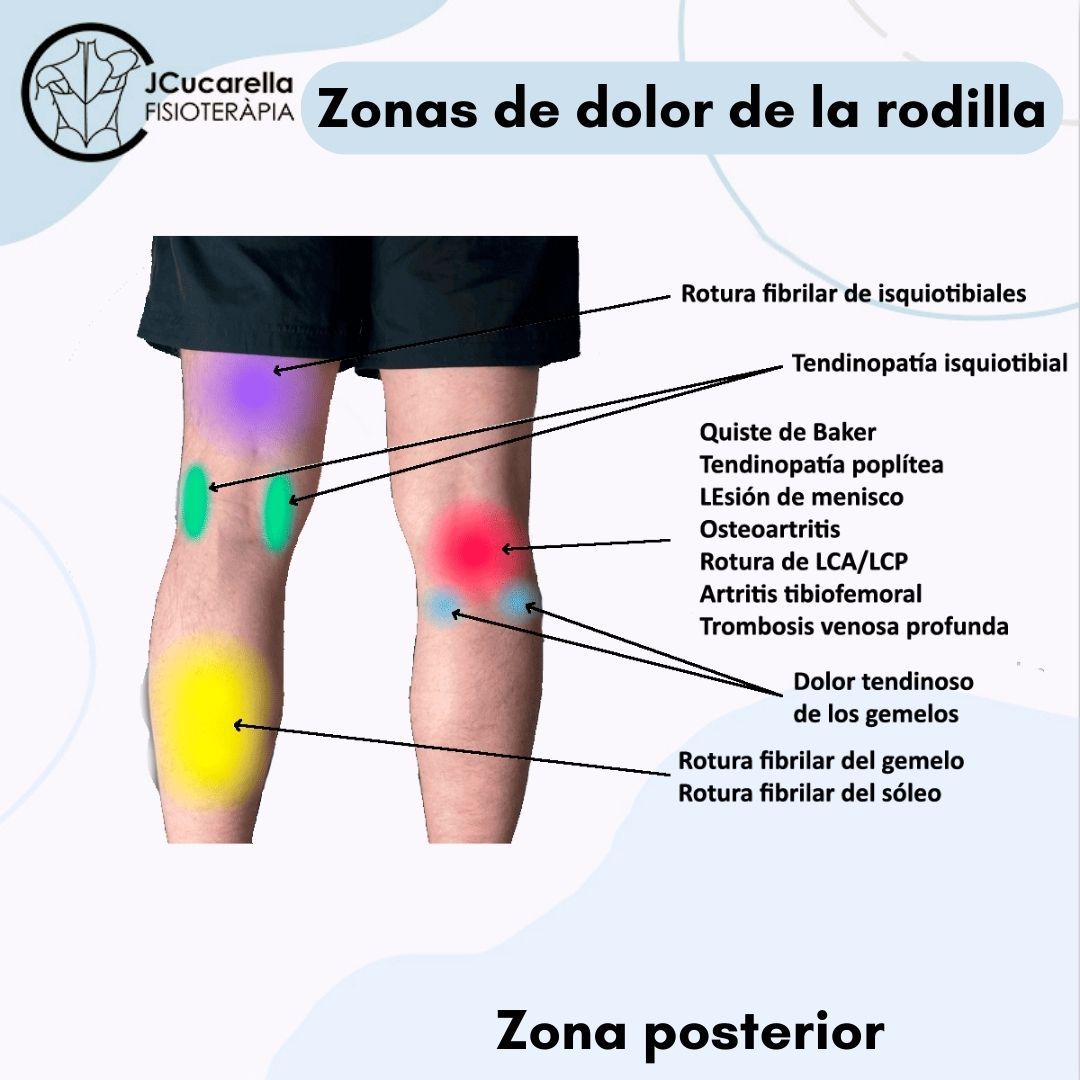 Javier Cucarella Bellvís-10