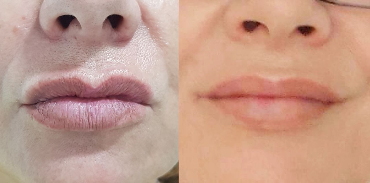 Rosalba Herrero Zerpa-160