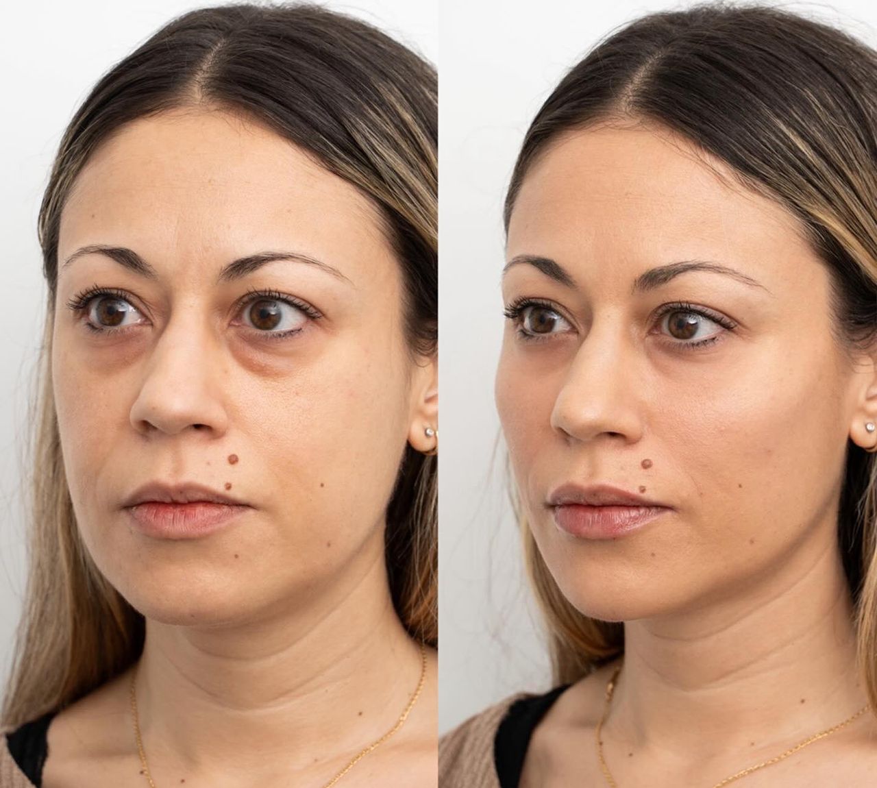 Raquel Moreno Pentinel-69