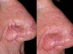 Enzo Angelo Giudice-4