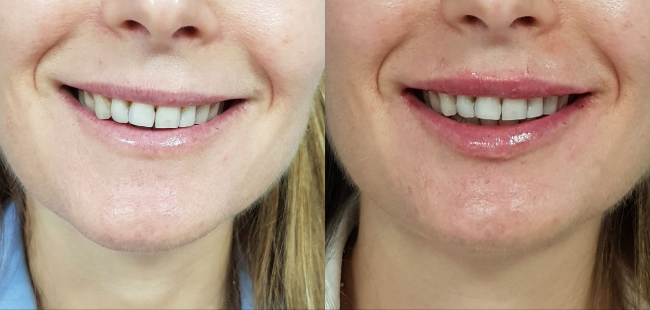 Rosalba Herrero Zerpa-485