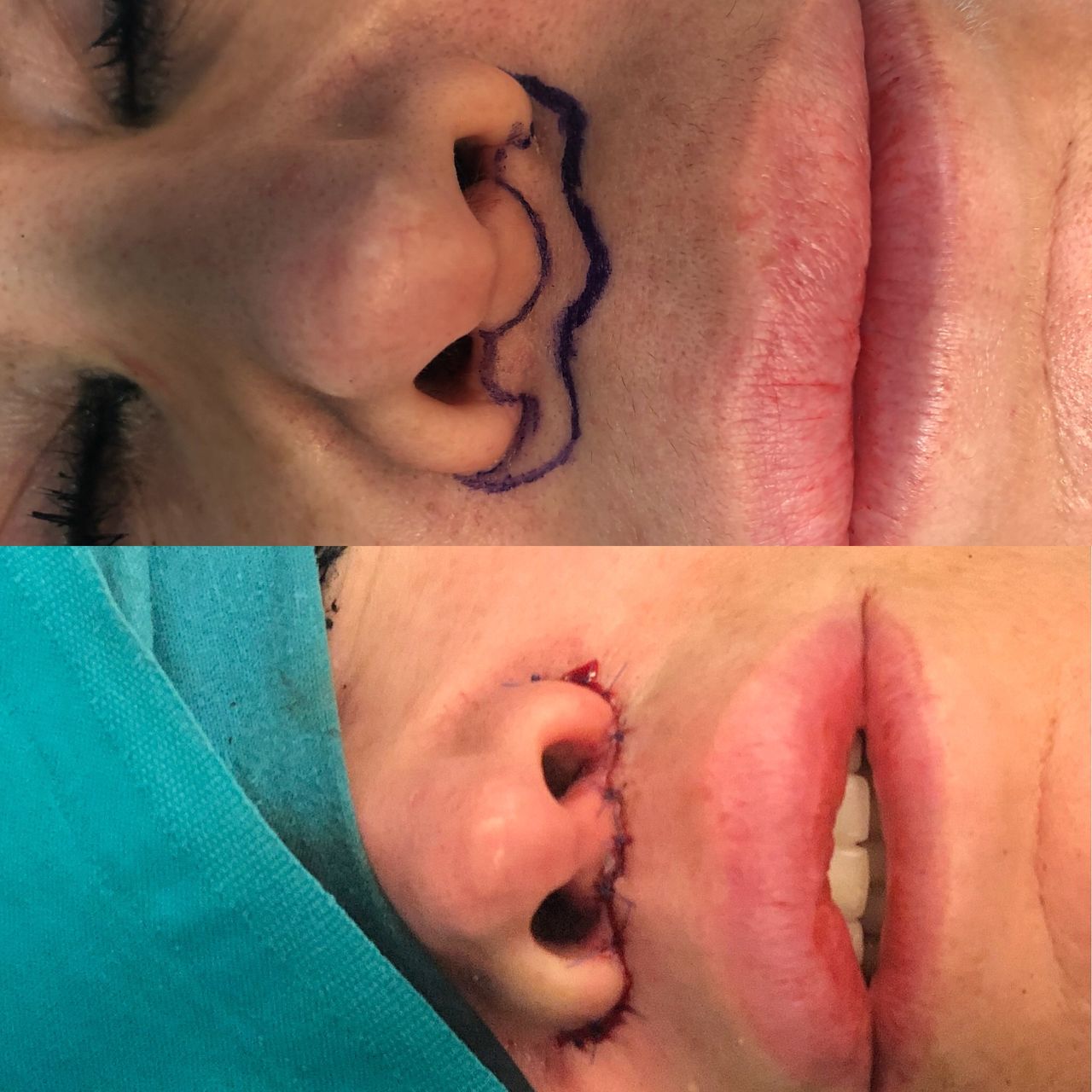 Alberto Candau Álvarez-22