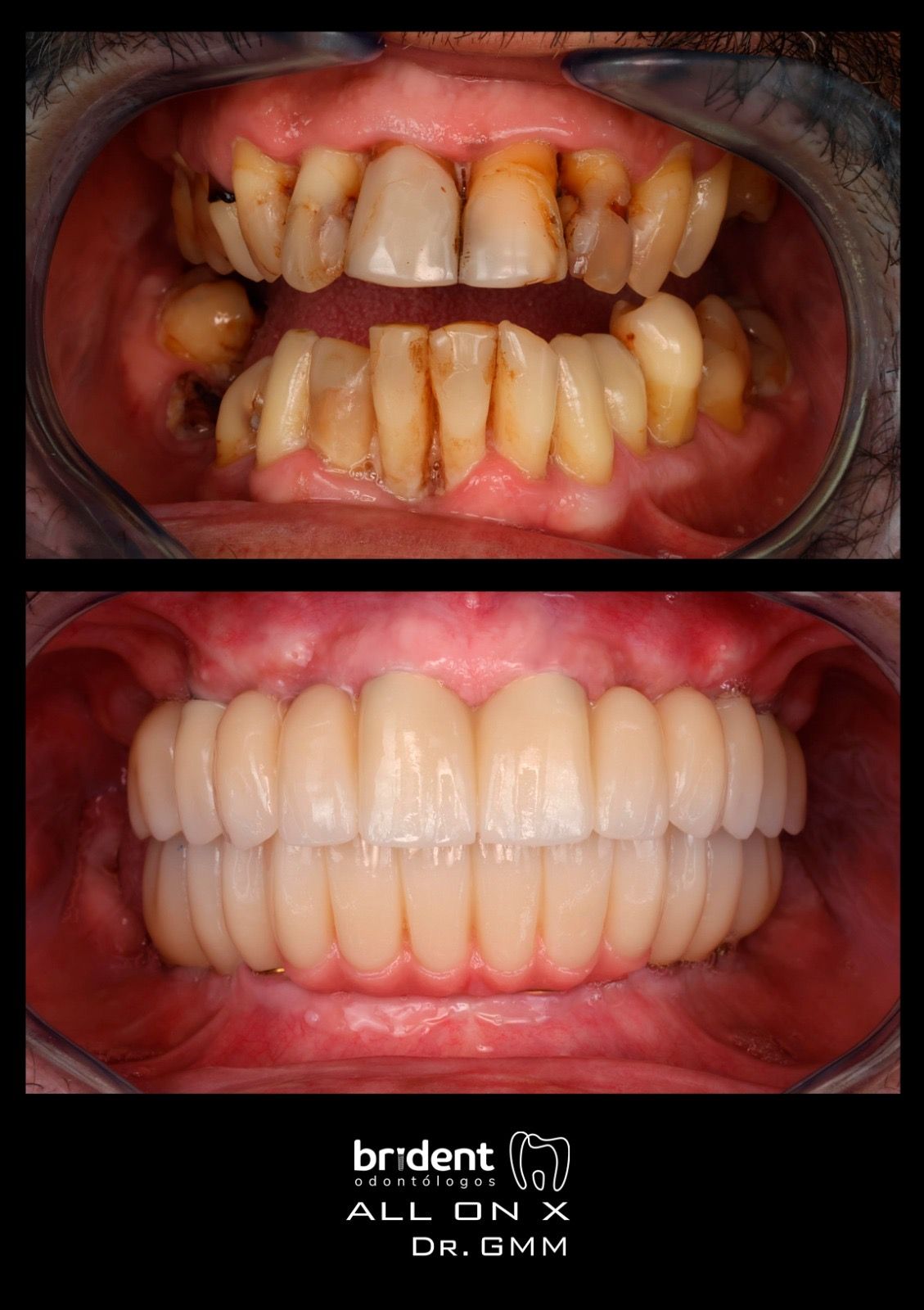 Guillermo Moreno Masiá-80