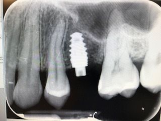 Zbigniew Mariusz Kapuściński-10