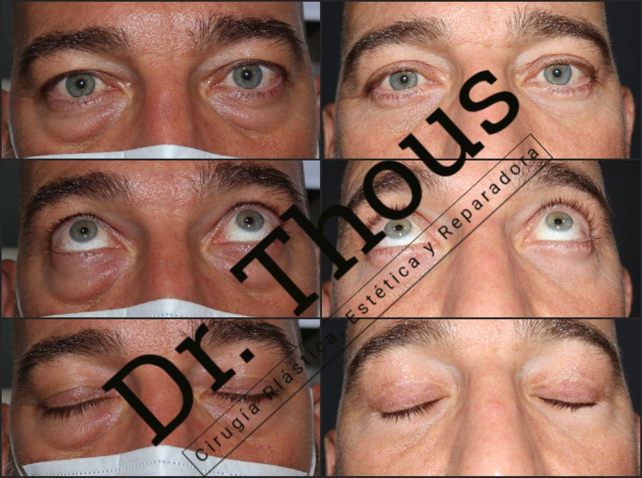 Juan Pedro Thous Fernández-5