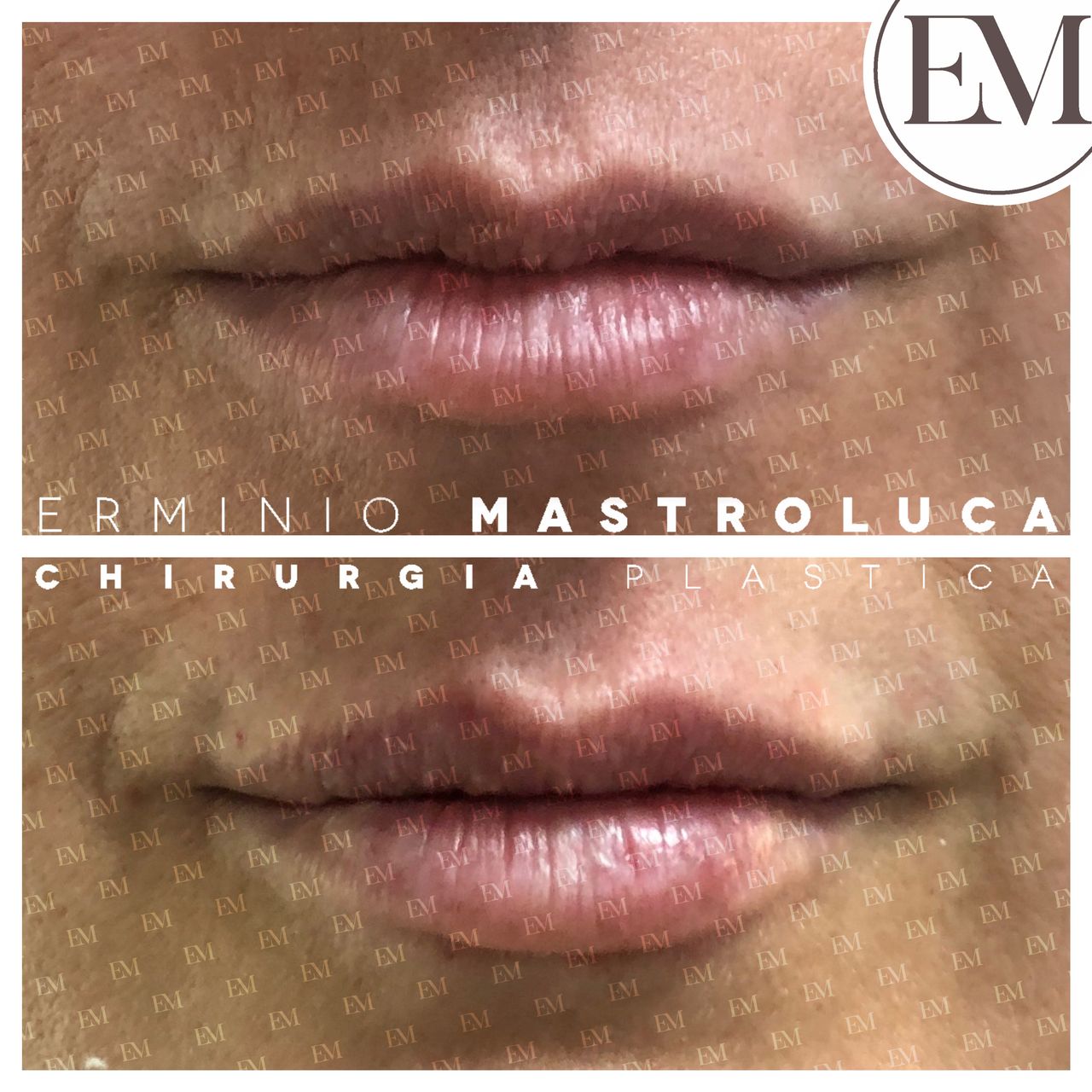 Erminio Mastroluca-2