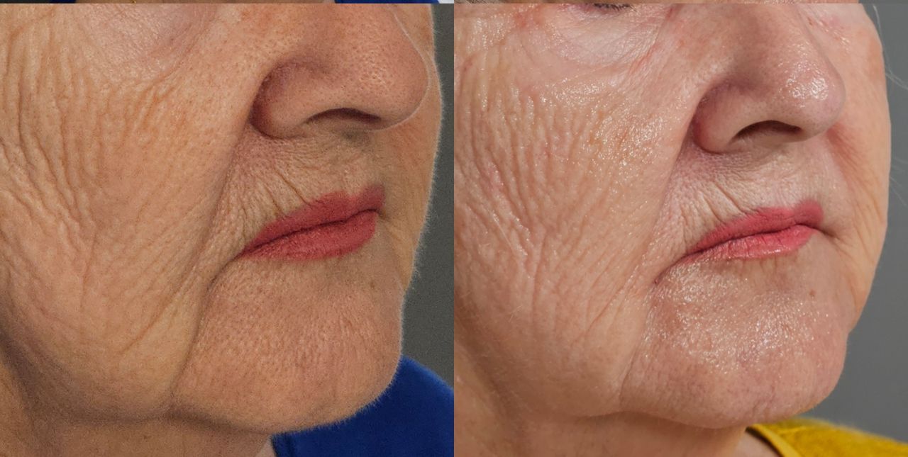 Rosalba Herrero Zerpa-14