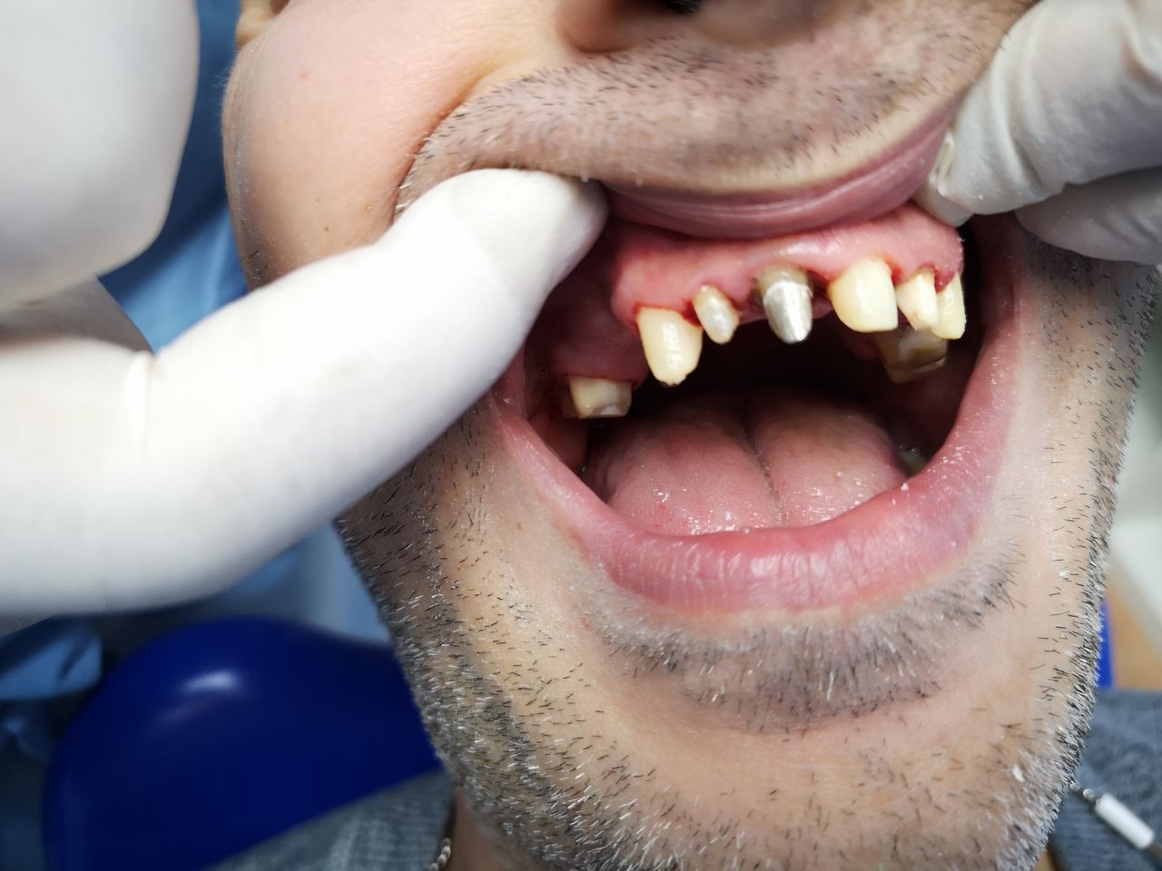 Stefano De Simone-106