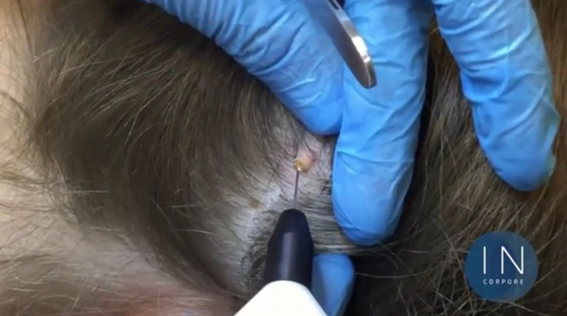 Juan Enrique Pérez Enríquez-94