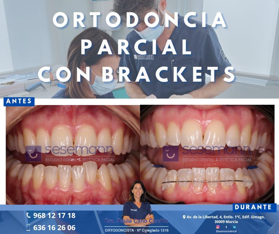 Paula Cano Carrillo-5