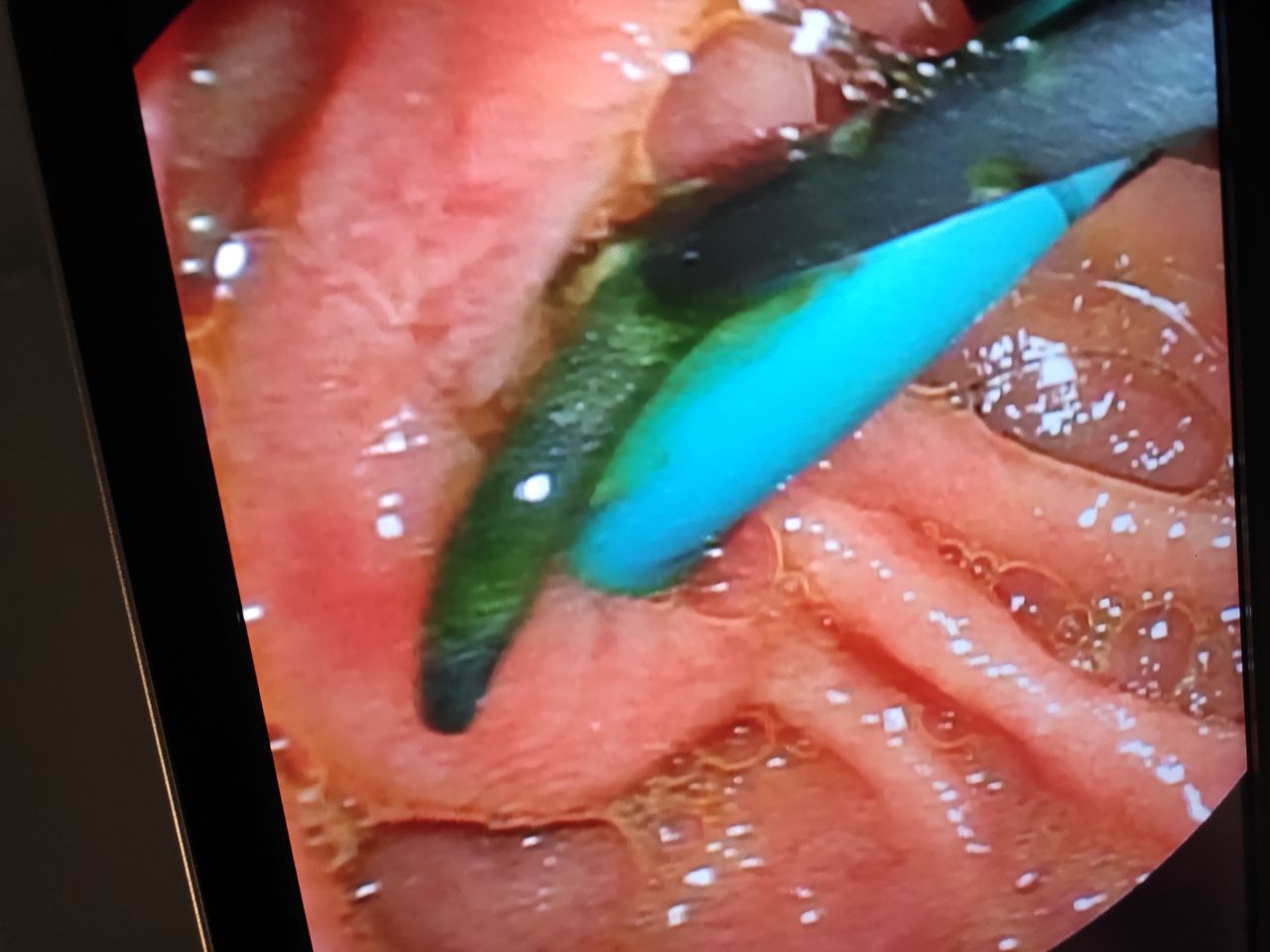 Juan Carlos Penalva Polo-1