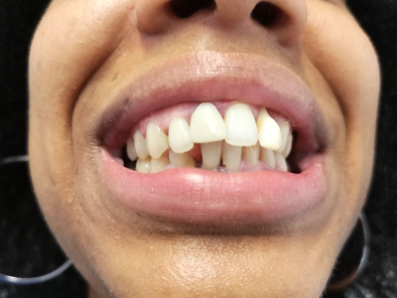 Stefano De Simone-36