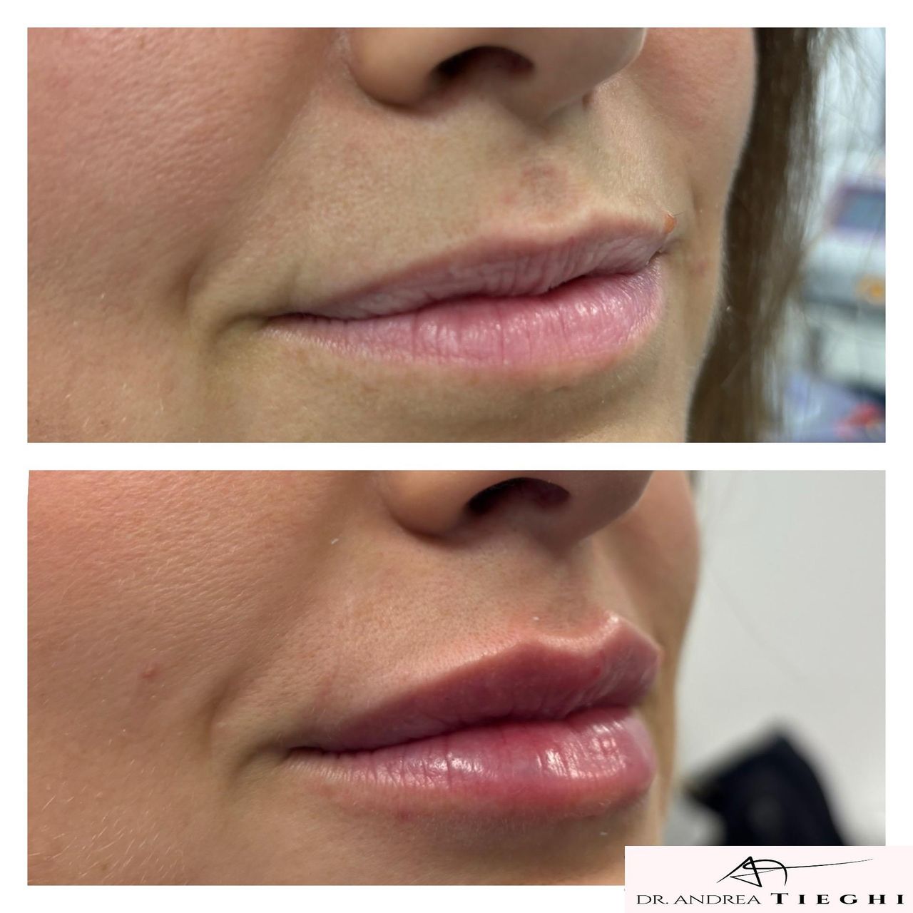 Andrea Tieghi-4