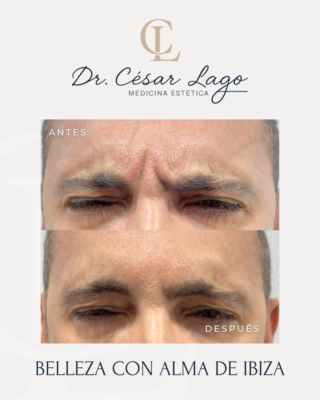 César Lago-7