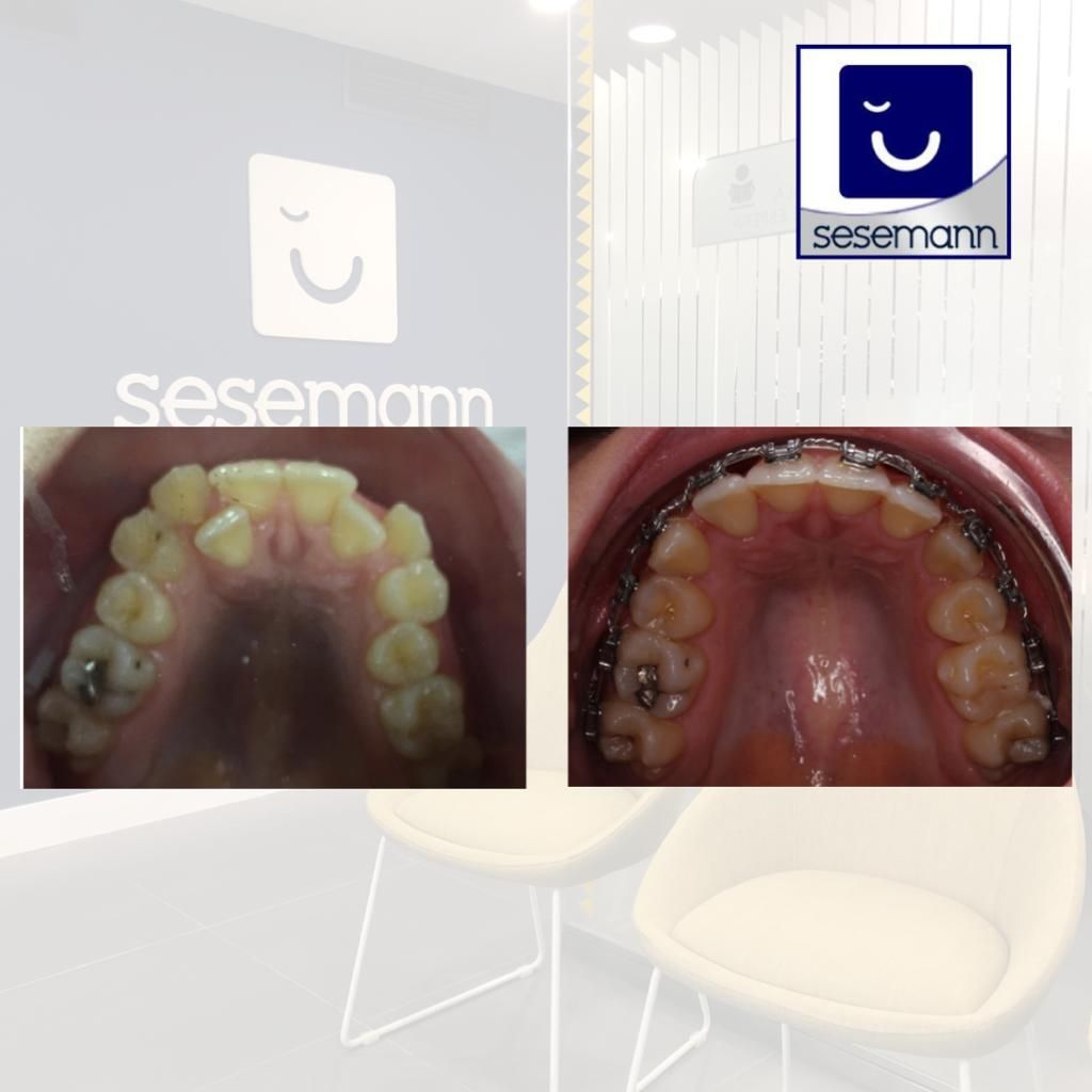 Paula Cano Carrillo-122