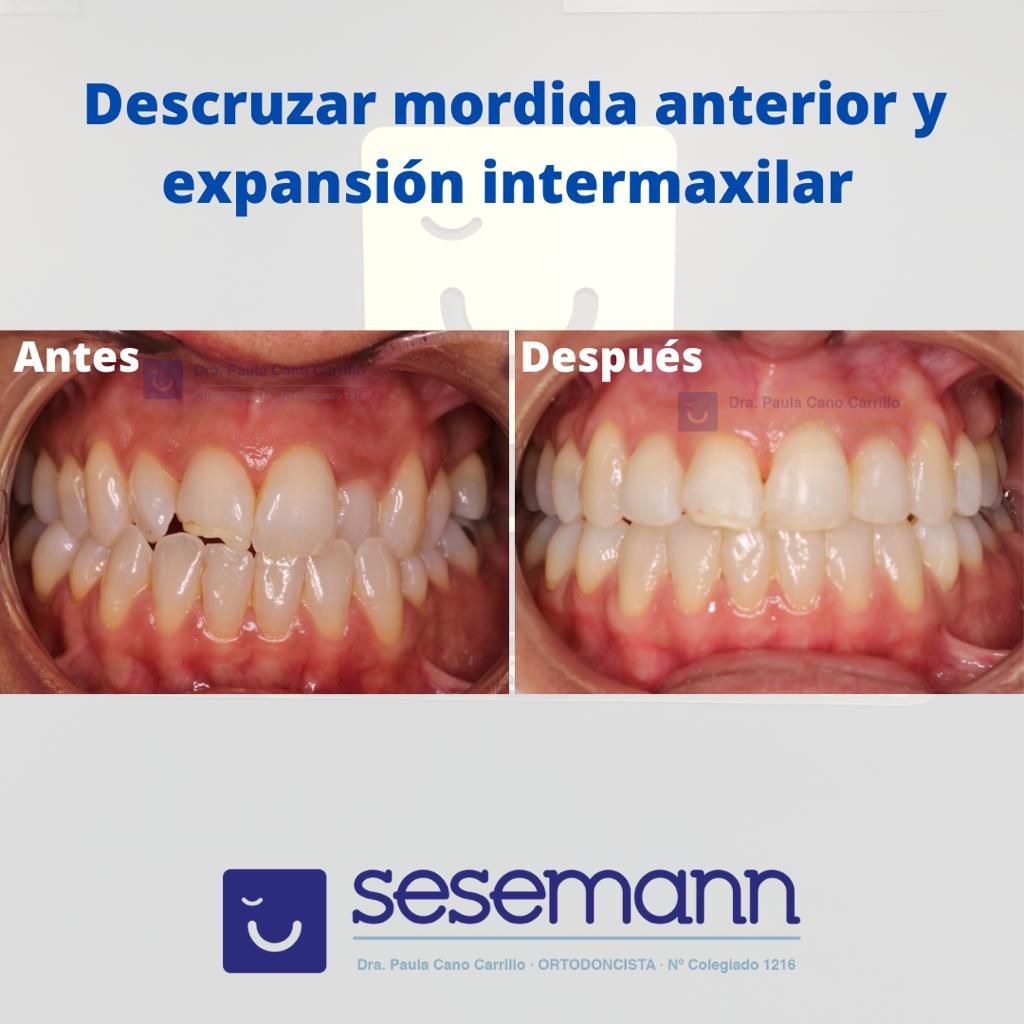 Paula Cano Carrillo-69