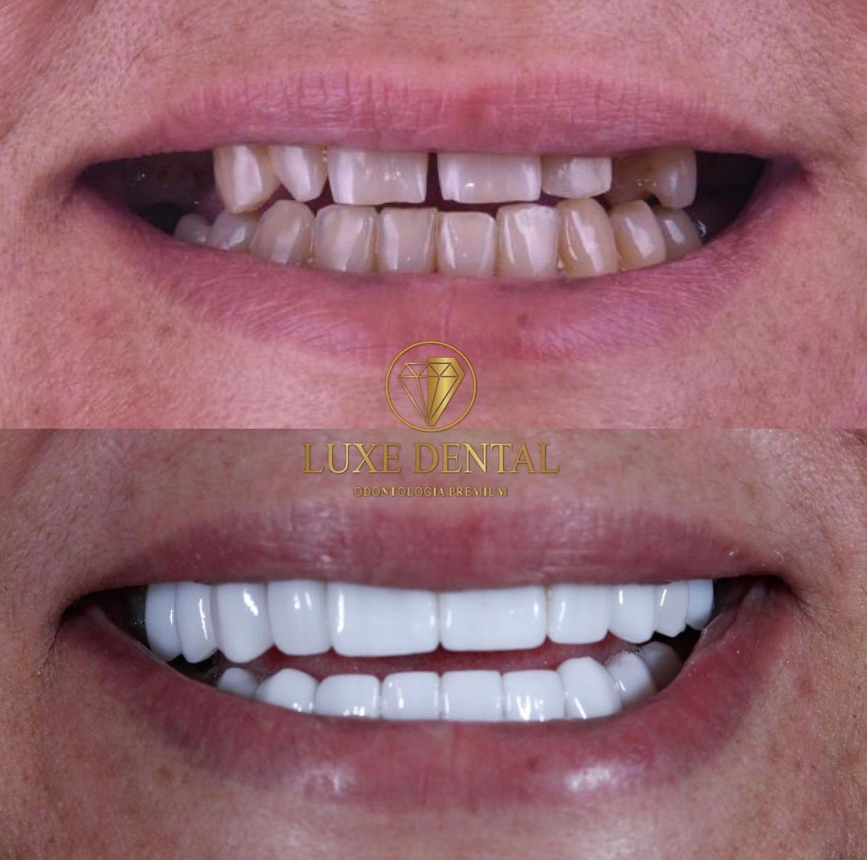 Ruben Patier Martin-12