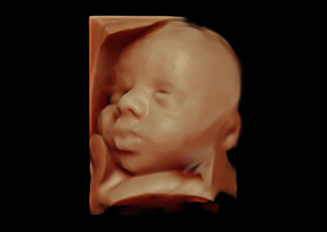 Pier Luigi Salzillo-4