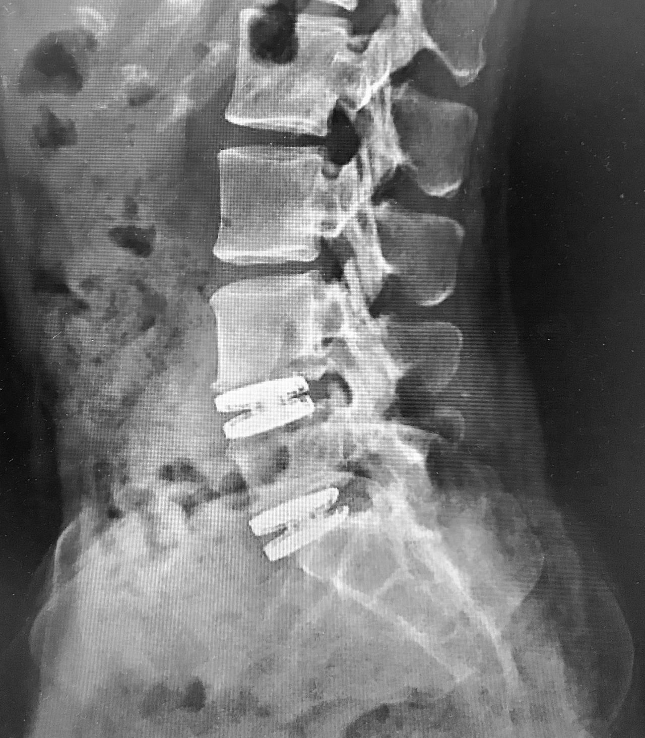 Juan Camilo Hernandez Acevedo-16