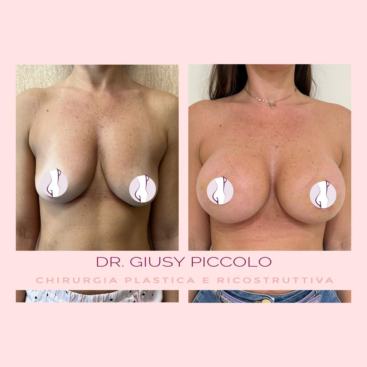 Giuseppina Piccolo-26