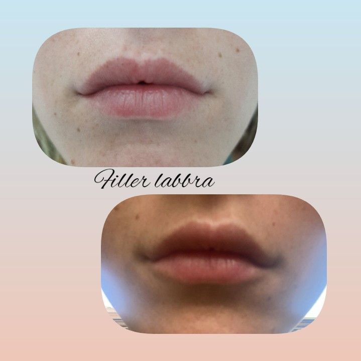 Paola Della Rocca-55