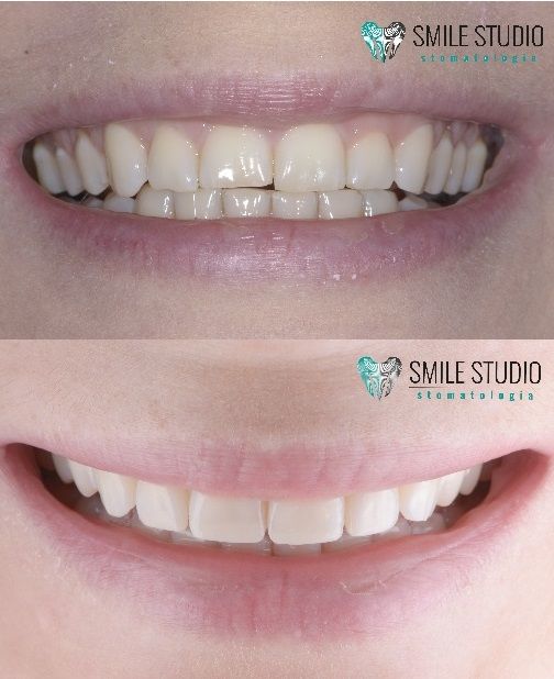 Michał Jankowski-15