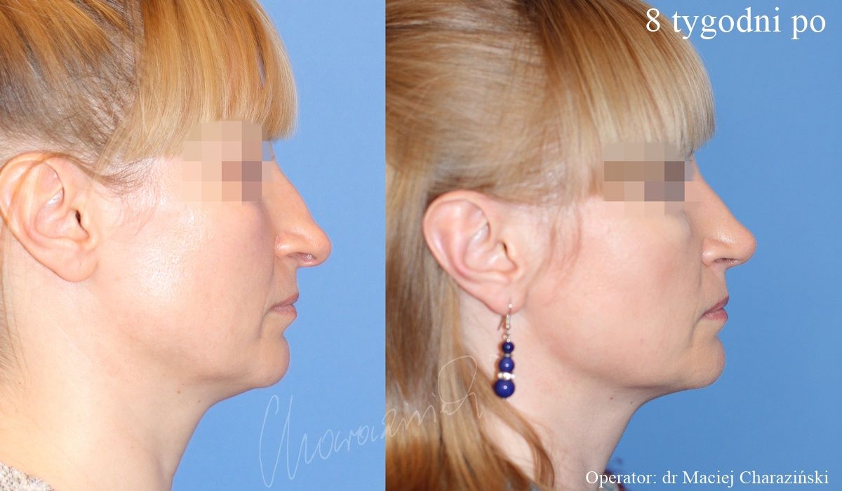 Maciej Charaziński-29