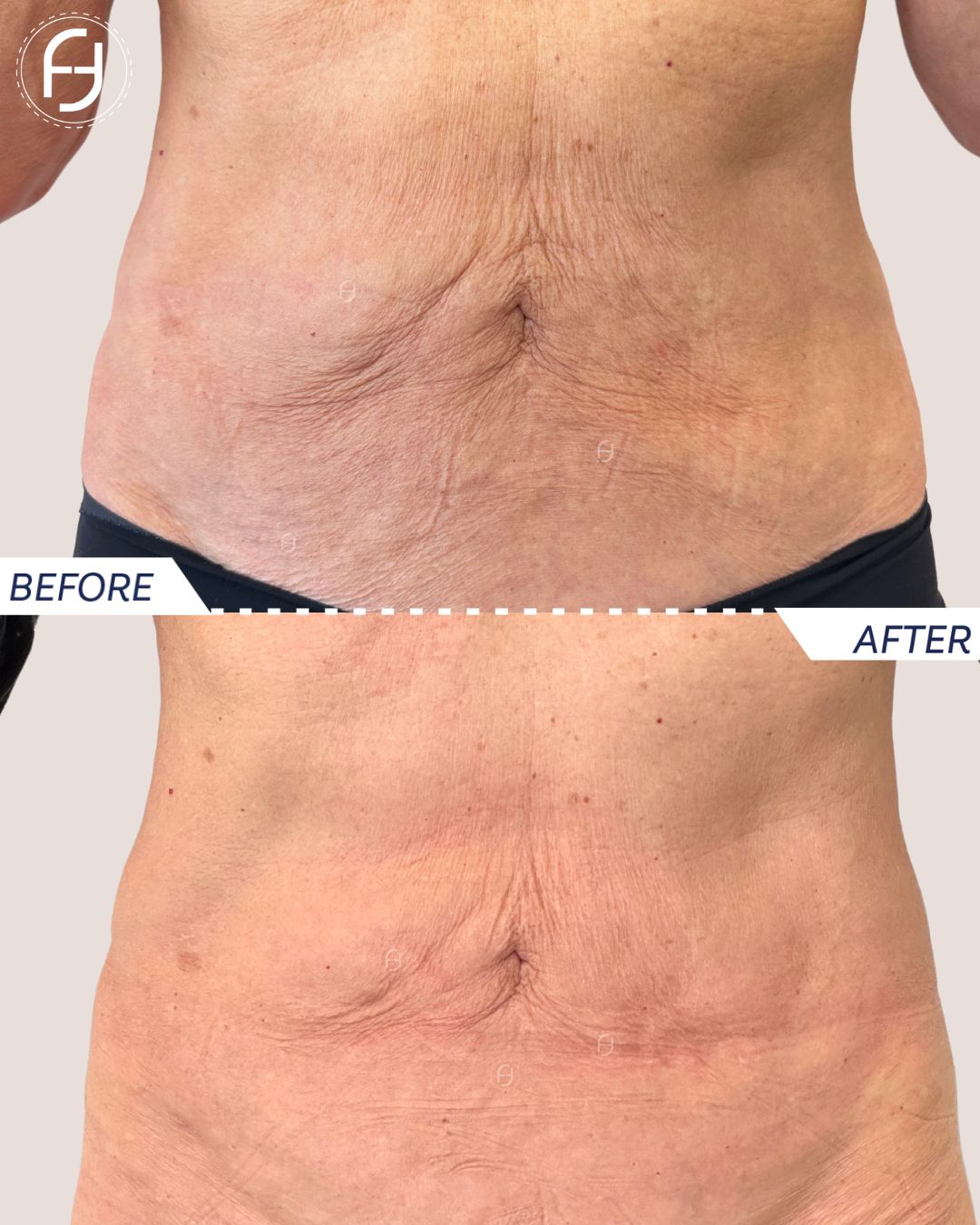 Francesca Flagiello-16