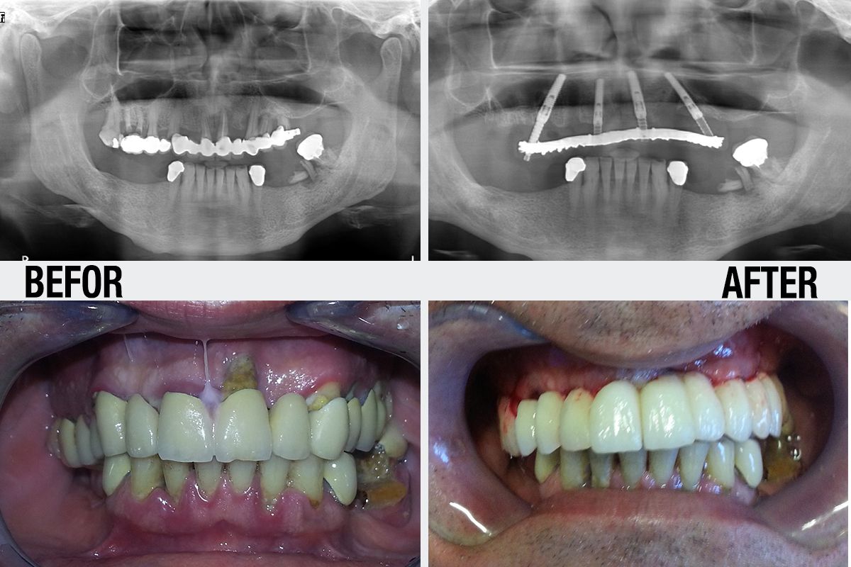 Alessandro Palumbo-42