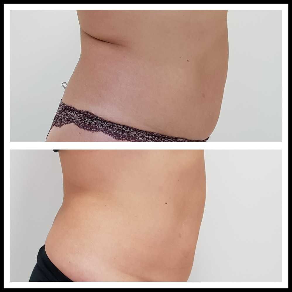 Rosalba Herrero Zerpa-366