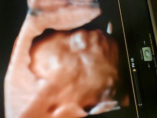 Domenico D'assisi-11