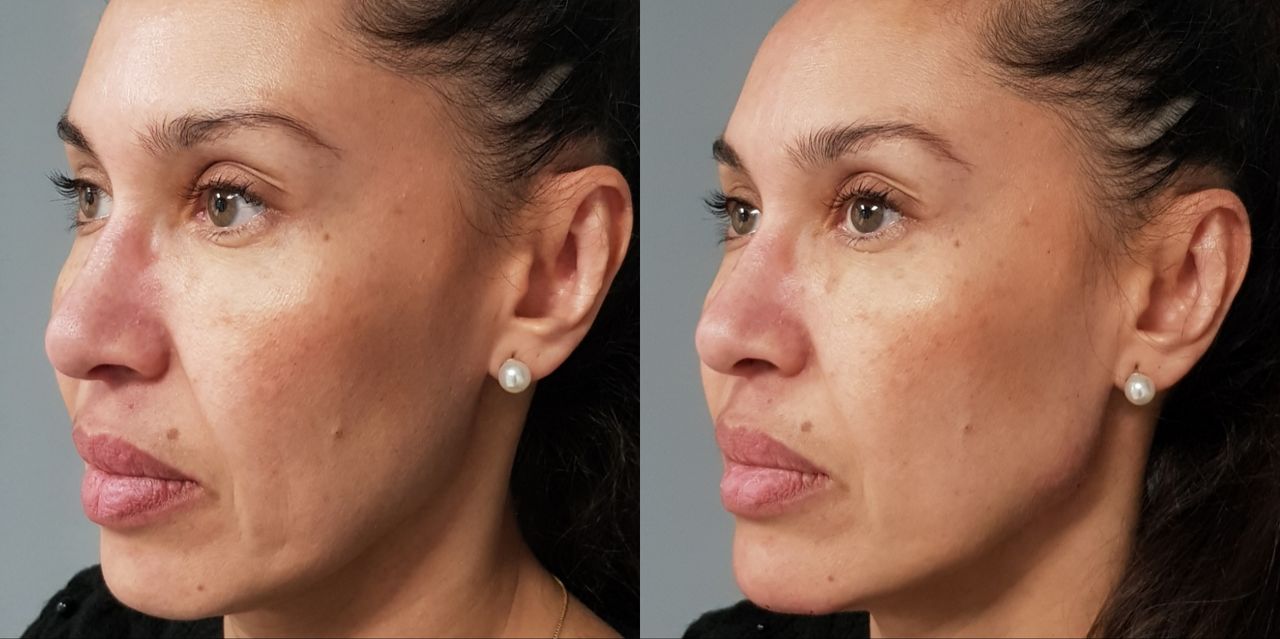 Rosalba Herrero Zerpa-68