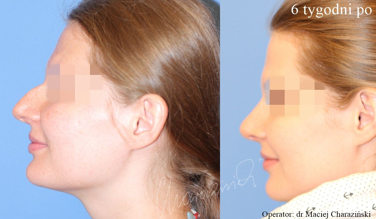 Maciej Charaziński-62