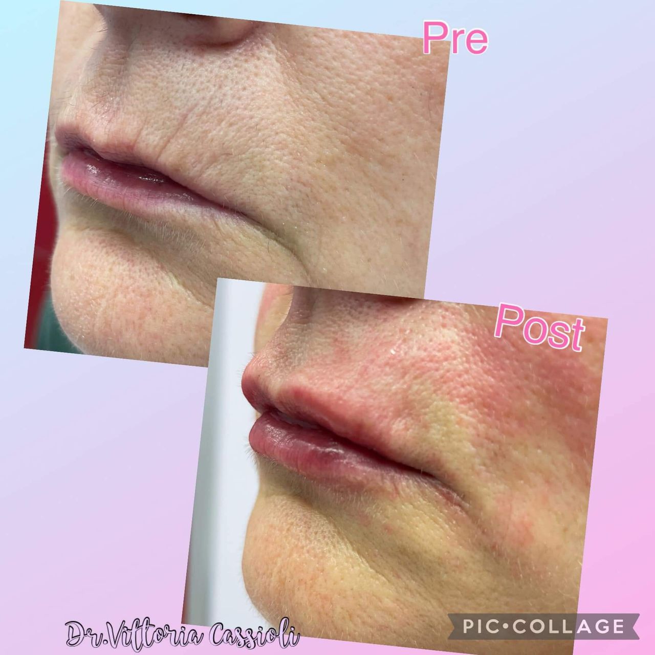 Vittoria Cassioli-71