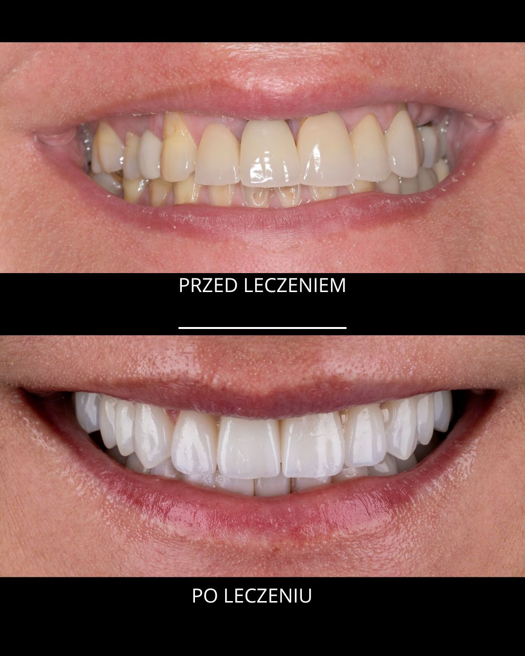 Agata Możyłowska-1