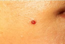 Enzo Angelo Giudice-9