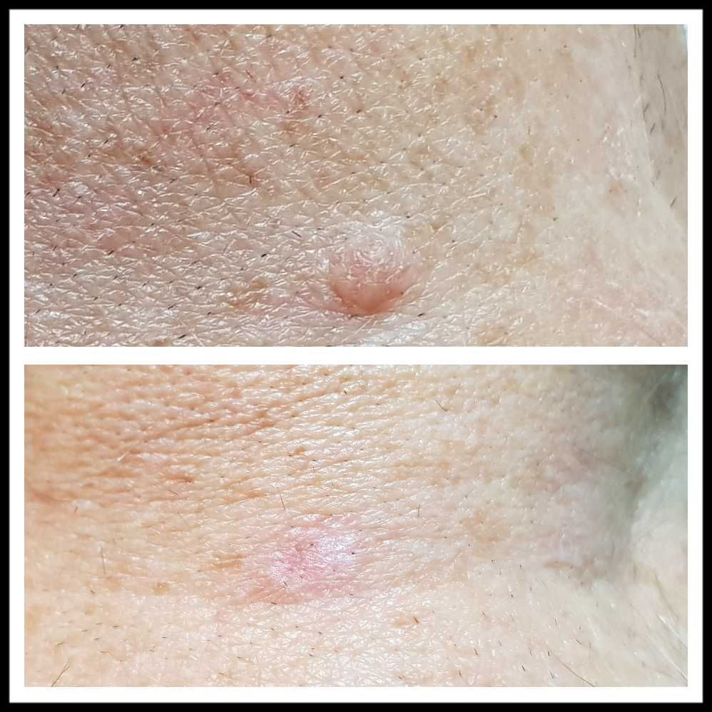 Rosalba Herrero Zerpa-383