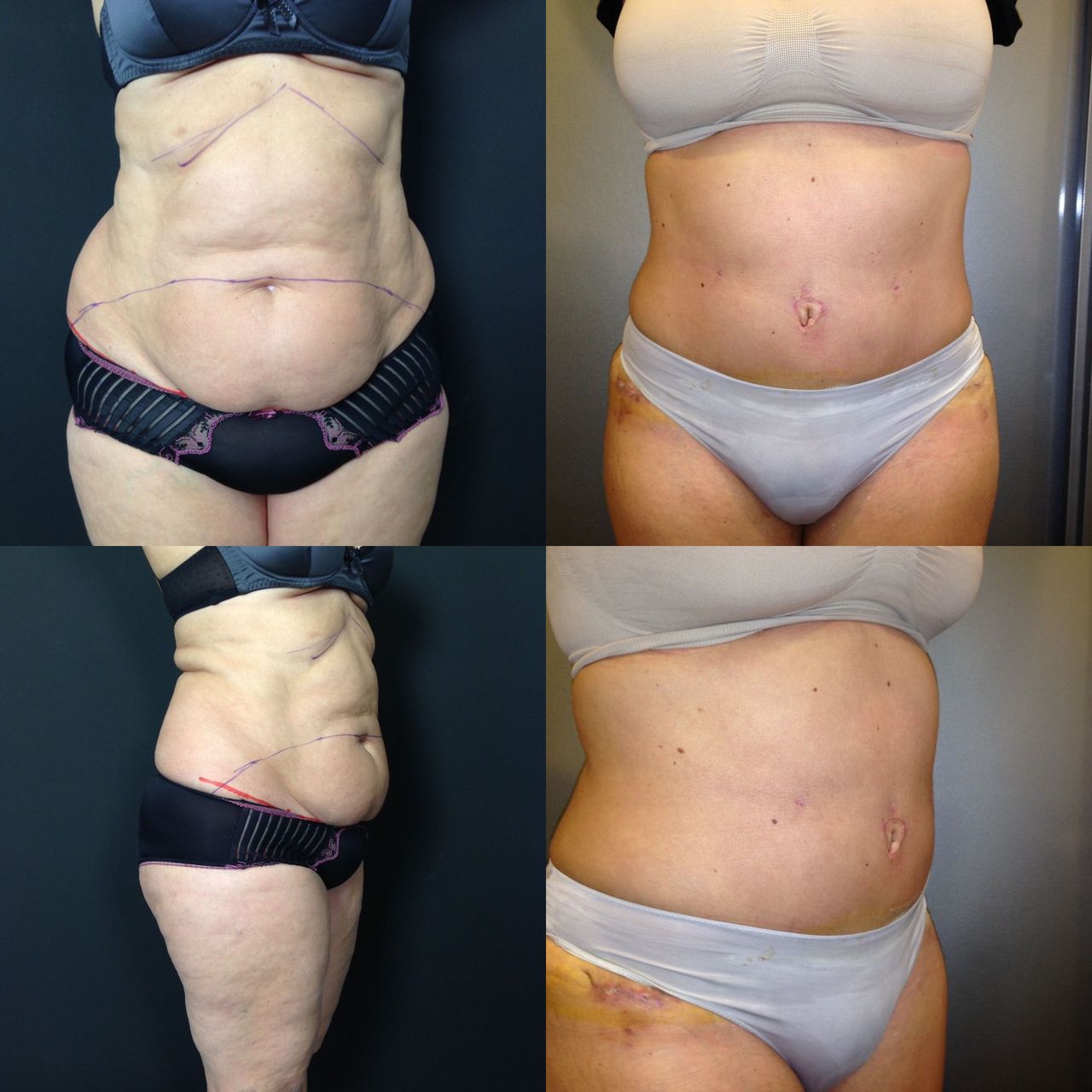 Pasquale Virciglio-45