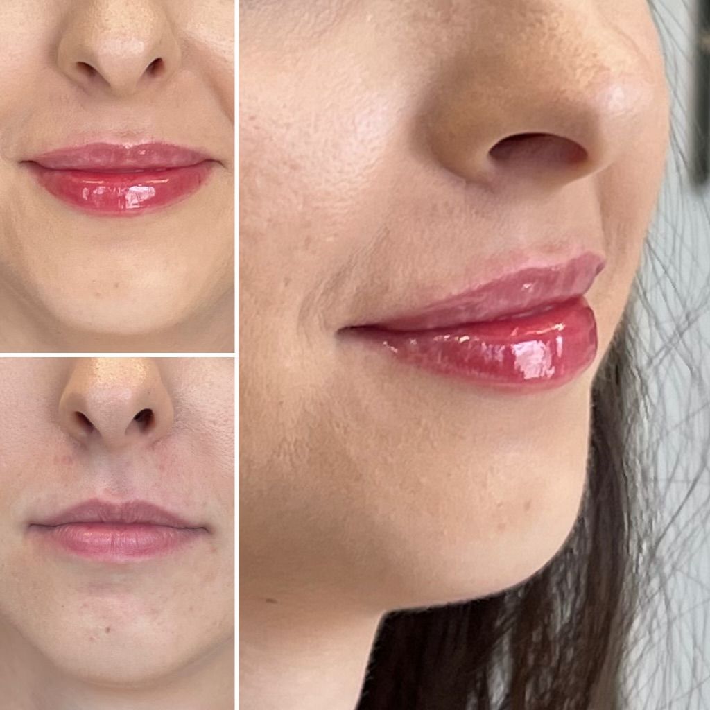 Dominika Kunysz-Schwermer-5