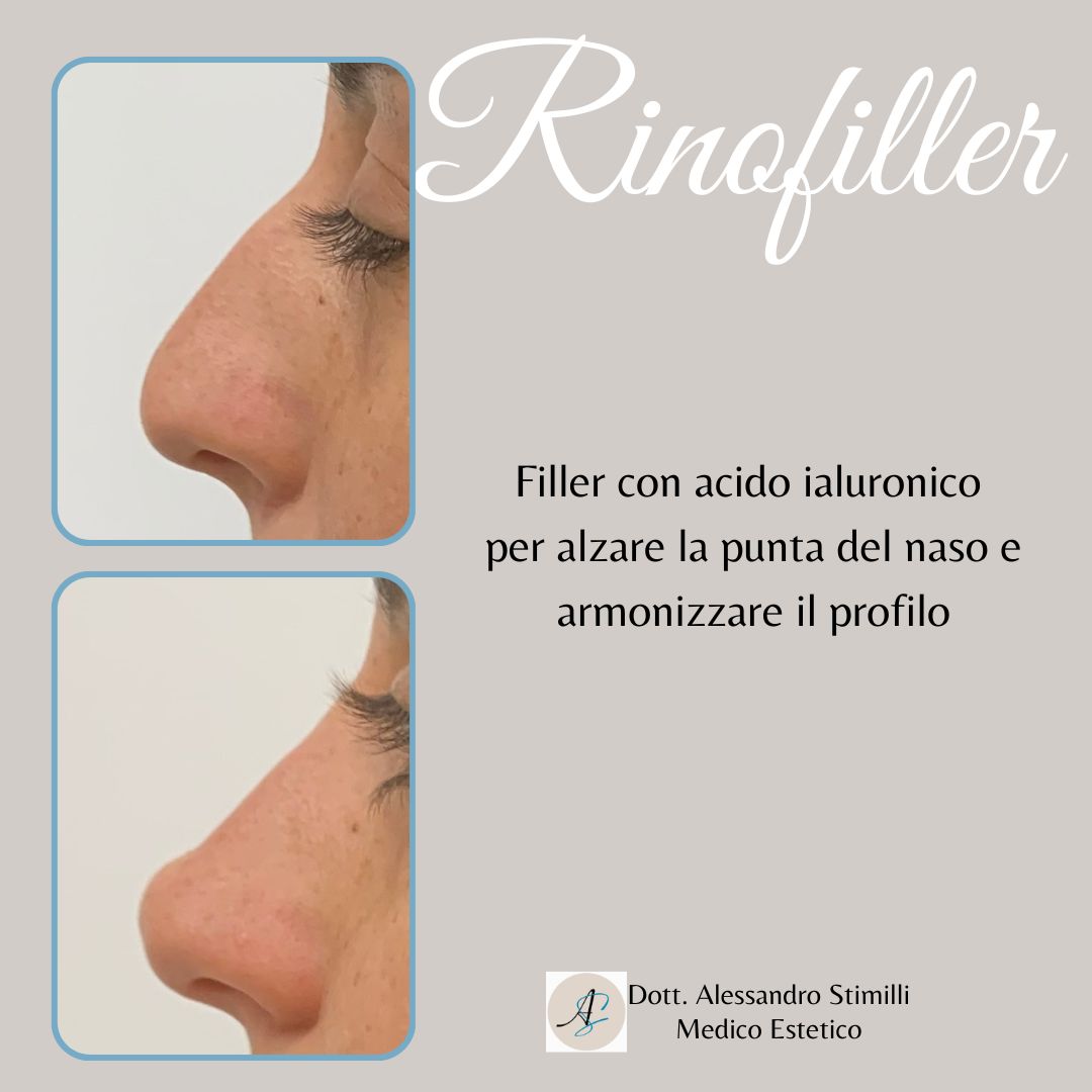 Alessandro Stimilli-19