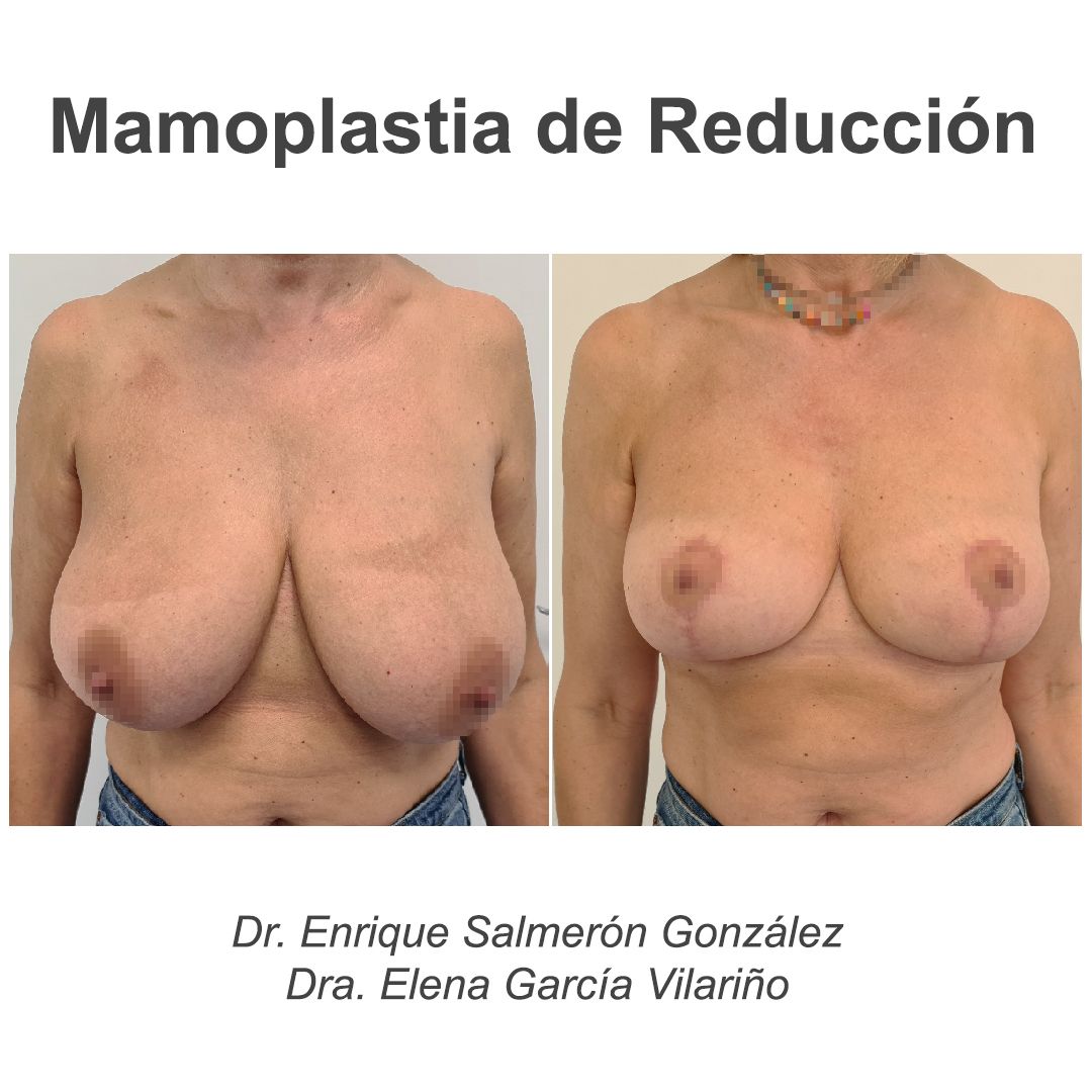 Enrique Salmerón González-67